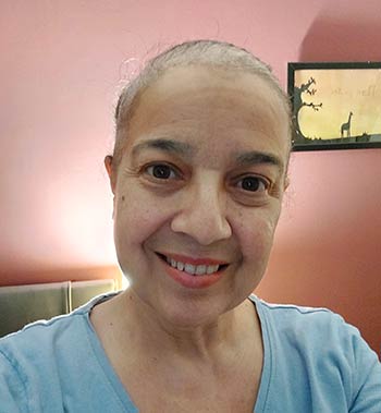 testemunho georgia sem cabelos